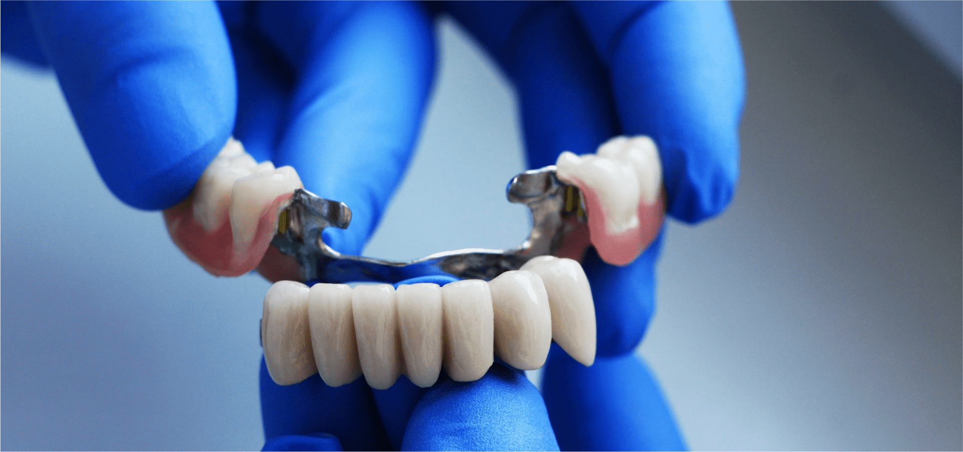 ClaspFree Partials Dentist in Pompano Beach, Florida