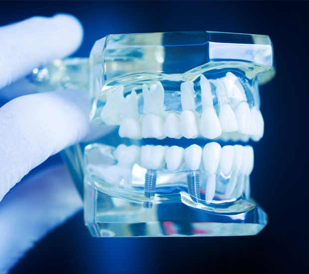 Pompano Beach Dental Implant Restoration