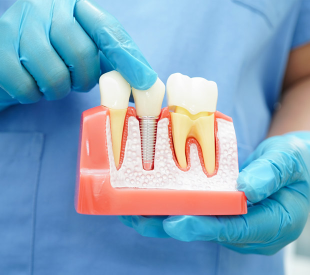 Pompano Beach Questions to Ask at Your Dental Implants Consultation