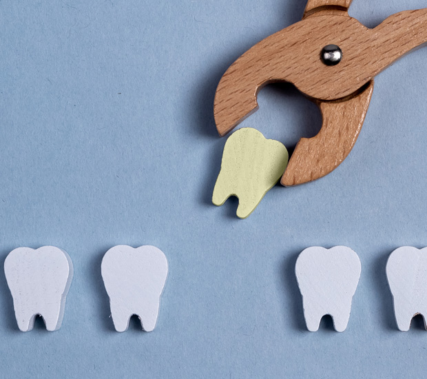 Pompano Beach Tooth Extraction
