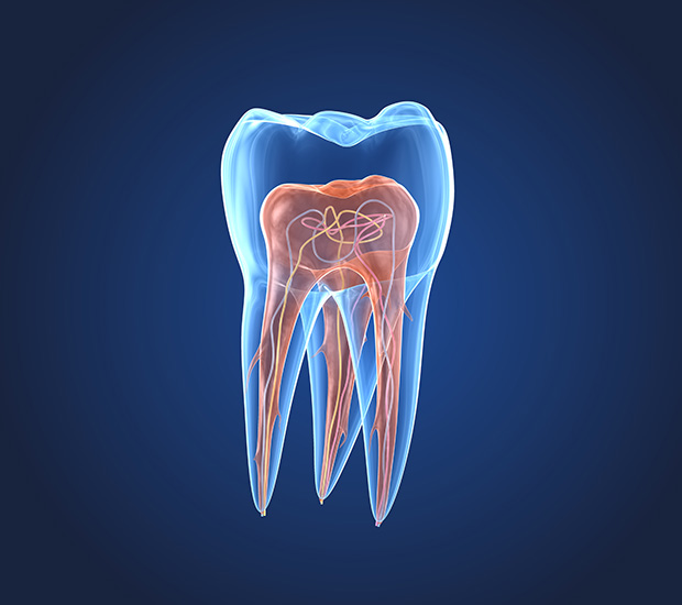 Pompano Beach What is an Endodontist