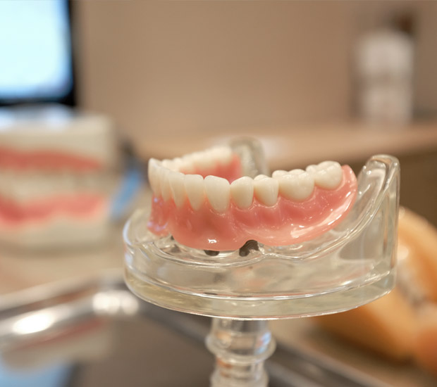 Pompano Beach What to Expect When Getting Dentures